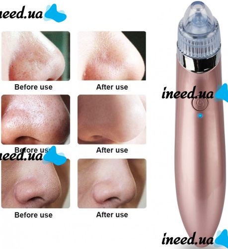 Вакуумный аппарат для лица Beauty Skin Care Specialist XN-8030 устройство очиститель, аппарат-очиститель пор для удаления акне, чистки кожи