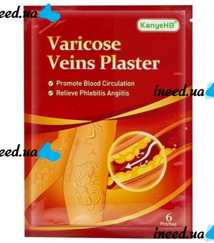 Телесный пластырь от варикоза KanyeHB Varicose Veins Plaster 6 шт, Комплект патчей от варикозного расширения вен и васкулита, Антиварикозные пластыри