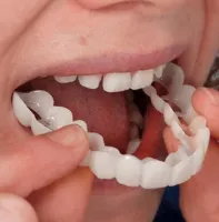 Removable veneers for upper and lower jaws SnapOn Smile Veneers LY-11 for teeth, Snap On Smile Veneers 2 jaws with case, False teeth top, bottom