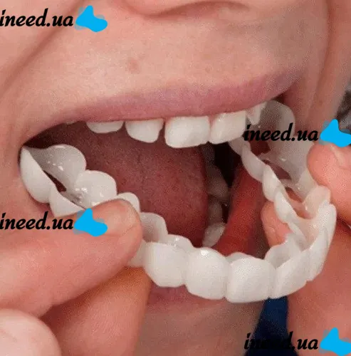 Removable veneers for upper and lower jaws SnapOn Smile Veneers LY-11 for teeth, Snap On Smile Veneers 2 jaws with case, False teeth top, bottom