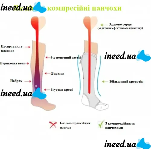 Компрессионные гольфы от варикоза Zip Sox, облегающие лечебные чулки, носки для фиксации лодыжек Зип Сокс со змейкой, Черные S/M, L/XL