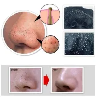 Dermacol Black Peel Off Mask in 120ml tube against blackheads and black spots.