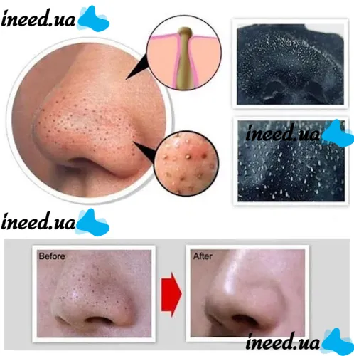 Dermacol Black Peel Off Mask in 120ml tube against blackheads and black spots.