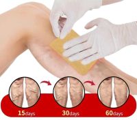 Телесный пластырь от варикоза KanyeHB Varicose Veins Plaster 6 шт, Комплект патчей от варикозного расширения вен и васкулита, Антиварикозные пластыри