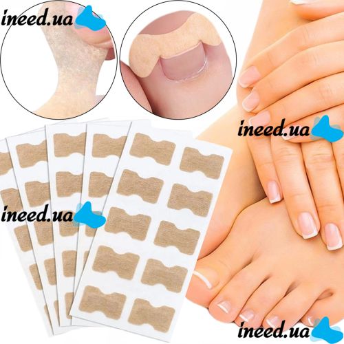 Набор пластырей Elastic Toenail Correction Sticker 50 шт для коррекции врастающих ногтей Телесный пластырь наклейка для устранения вросшего ногтя