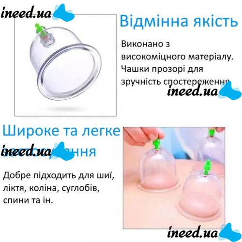 Вакуумные массажные антицеллюлитные банки с насосом - Pull Out a Vacuum Apparatus KL 24 шт, Медицинский набор из 24 вакуумных банок для массажа