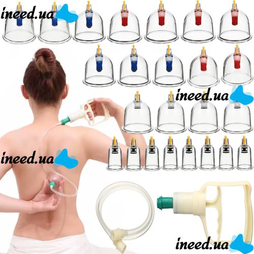 Feipujian KL-32 vacuum jar set for massage anti-cellulite massage jars for the whole body and hijams with KL32 vacuum pump, set of 32 pieces