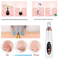 Вакуумный очиститель пор для чистки кожи лица Multi-Functional Cleaning MF-64, вакуумный аппарат-очиститель, аппарат от черных точек, лифтинг