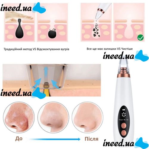 Вакуумный очиститель пор для чистки кожи лица Multi-Functional Cleaning MF-64, вакуумный аппарат-очиститель, аппарат от черных точек, лифтинг