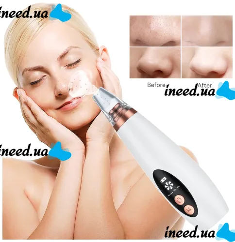 Вакуумный очиститель пор для чистки кожи лица Multi-Functional Cleaning MF-64, вакуумный аппарат-очиститель, аппарат от черных точек, лифтинг