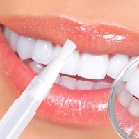 Карандаш для отбеливания зубов Teeth Whitening Dazzling White отбеливающие гель средство для осветления зубной эмали, отбеливатель гель-карандаш 2 мл