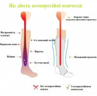 Компрессионные гольфы от варикоза Zip Sox, облегающие лечебные чулки, носки для фиксации лодыжек Зип Сокс со змейкой, Бежевые S/M, L/XL