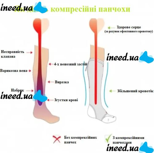 Компрессионные гольфы от варикоза Zip Sox, облегающие лечебные чулки, носки для фиксации лодыжек Зип Сокс со змейкой, Бежевые S/M, L/XL
