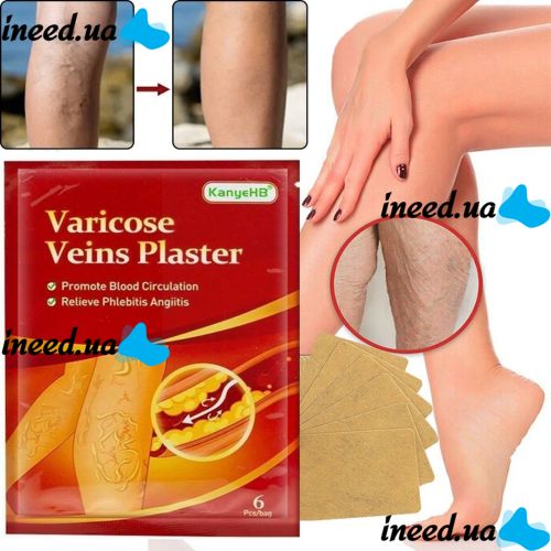 Телесный пластырь от варикоза KanyeHB Varicose Veins Plaster 6 шт, Комплект патчей от варикозного расширения вен и васкулита, Антиварикозные пластыри