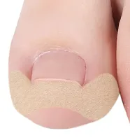 Набор пластырей Elastic Toenail Correction Sticker 50 шт для коррекции врастающих ногтей Телесный пластырь наклейка для устранения вросшего ногтя